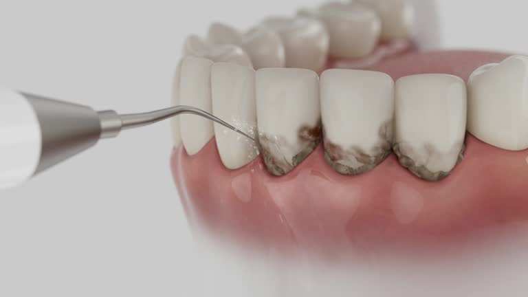 Reliable Dental contractor in Annapolis, MD by Smile Center Dentistry